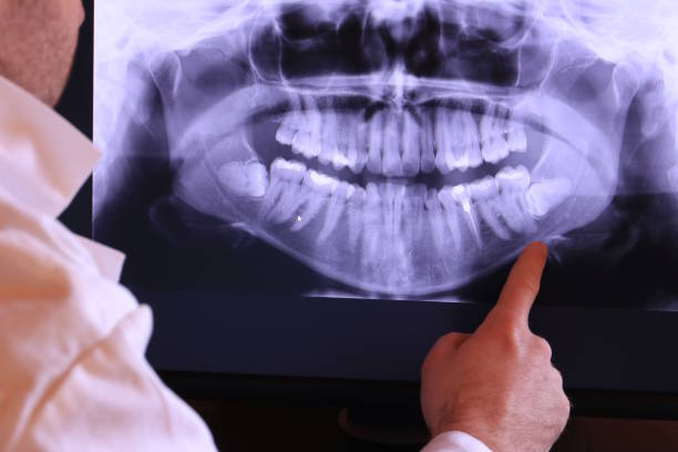 Best Emergency Treatment for Dental Infections or Abscesses in South Lebanon, OH