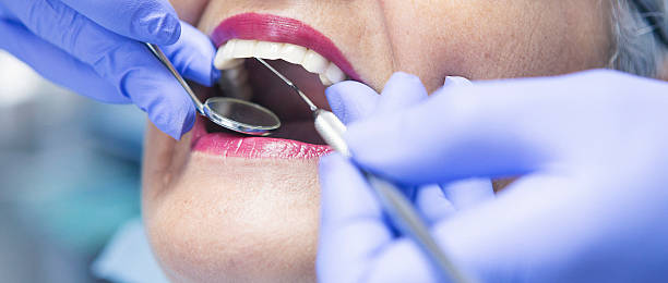 Best Emergency Treatment for Dental Infections or Abscesses in South Lebanon, OH